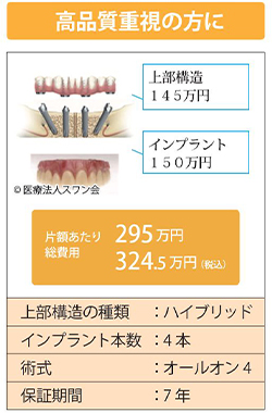 オールオン4価格表2